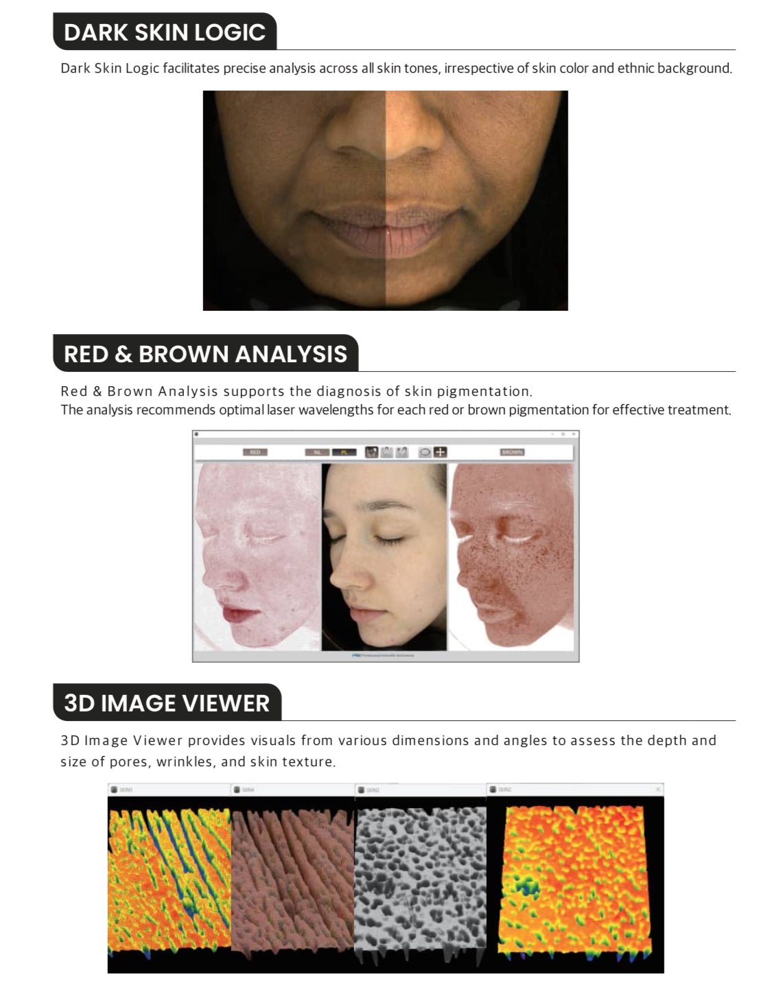 Line-Vu Skin Analyzer PSI PLUS