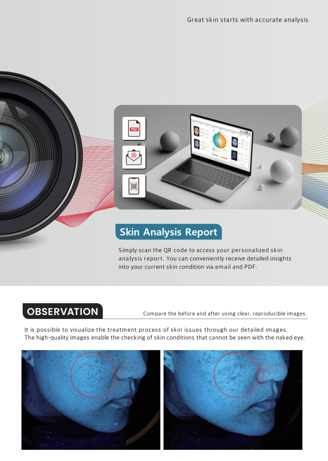 Line-Vu Skin Analyzer PSI PLUS